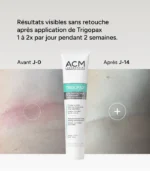 Acm Trigopax soin protecteur apaisant – 30 ml – Image 2